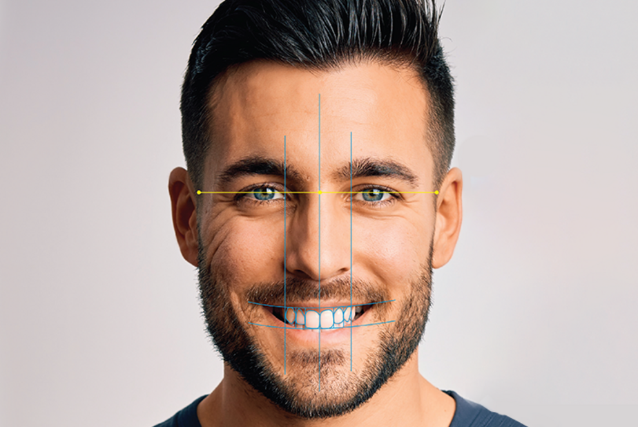 img invisalign
