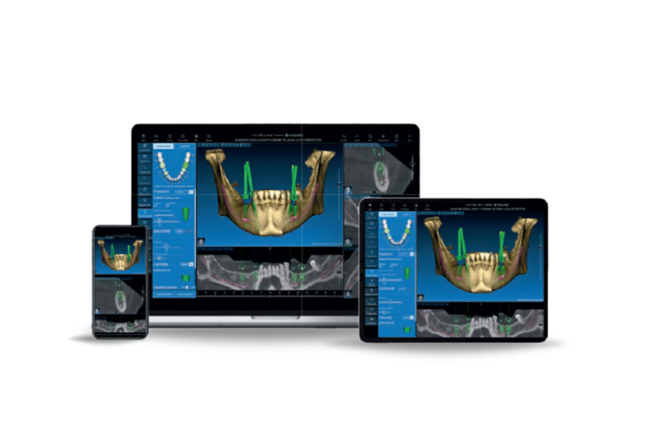 IsoGuide 3.0: la chirurgia Guidata senza limiti
