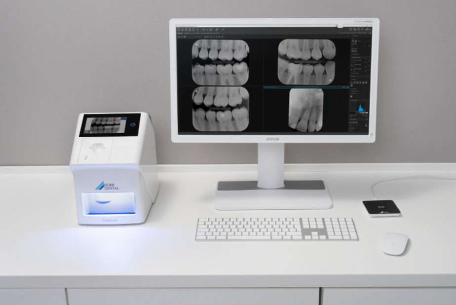 Workflow più semplice e veloce: la novità Smart Reader per VistaScan 2.0