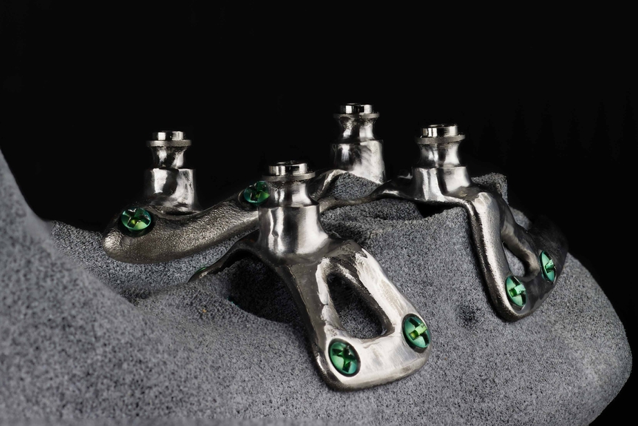 SP4, in implantologia possiamo parlare di quarto millennio