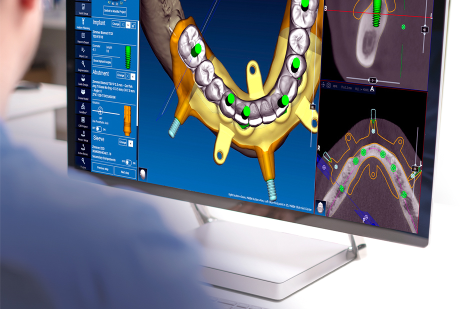 Persona che utilizza il software RealGUIDE™