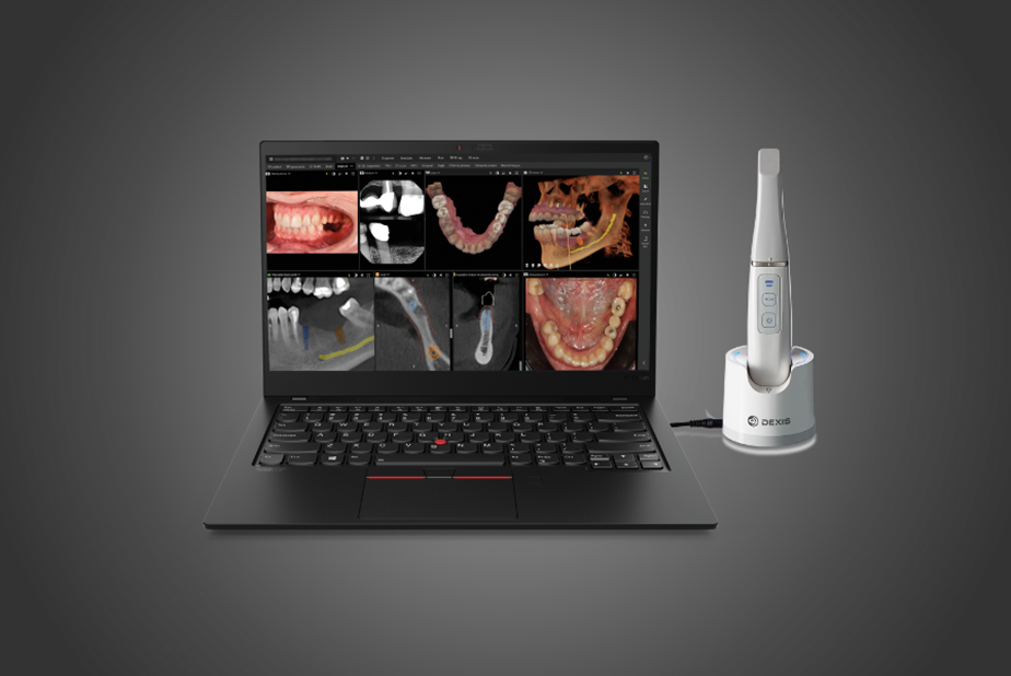 DTX Studio™ Clinic e le soluzioni DEXIS™ IOS