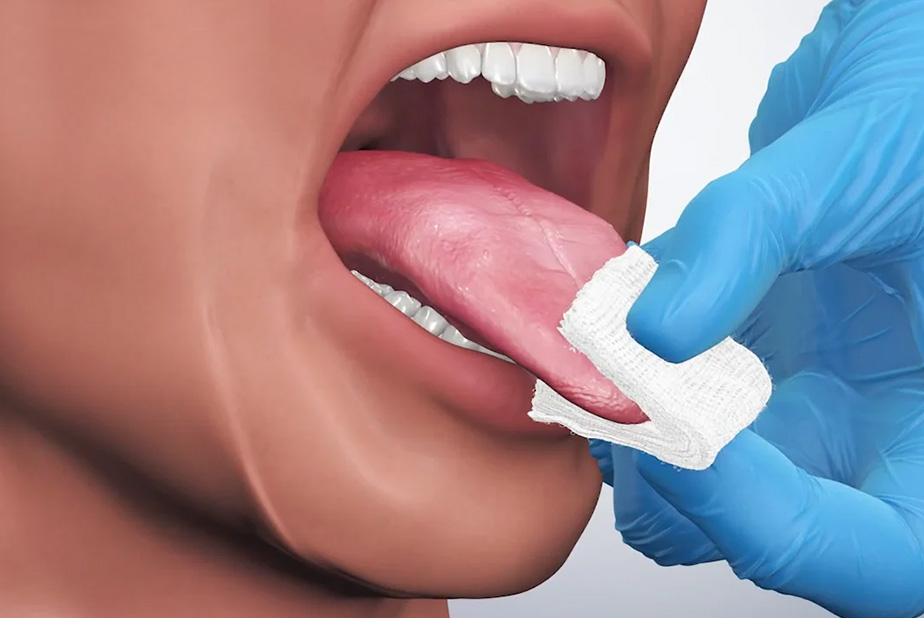 screening del cancro orale