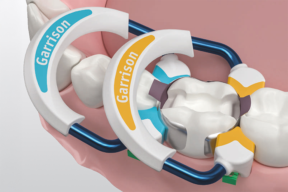 matrici sezionali Strata-G Garrison