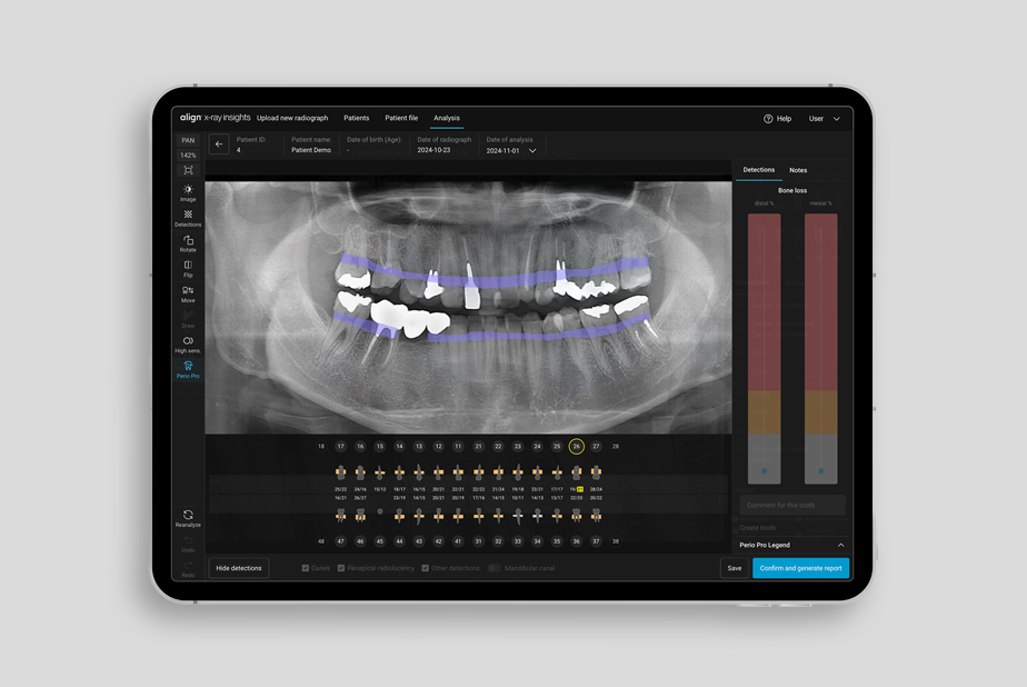 Align X-ray Insights