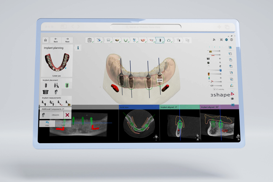 Implant Studio 2026.1