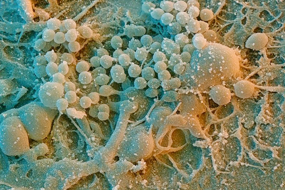 Batteri della placca