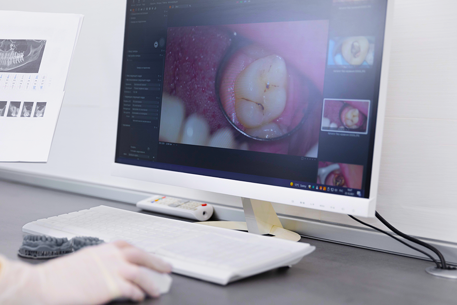 Digital photography e AI