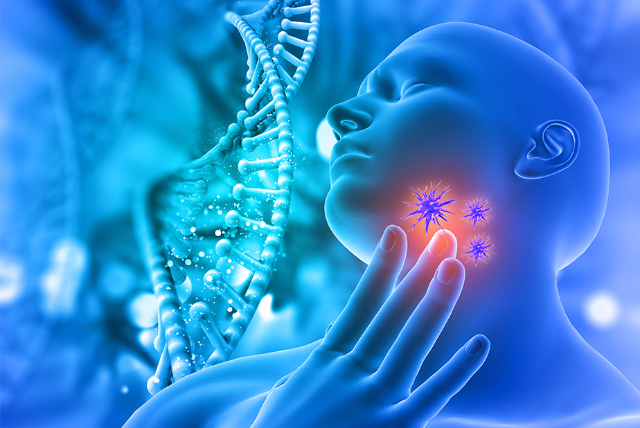 Modello con tumore alla gola